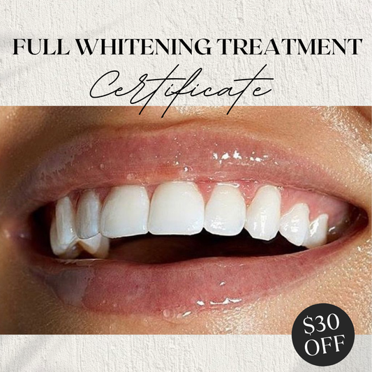 Full Whitening Treatment
